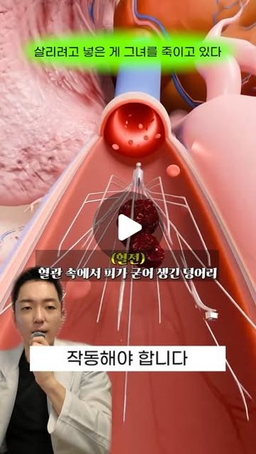 조회수 100만+ 릴스 표지